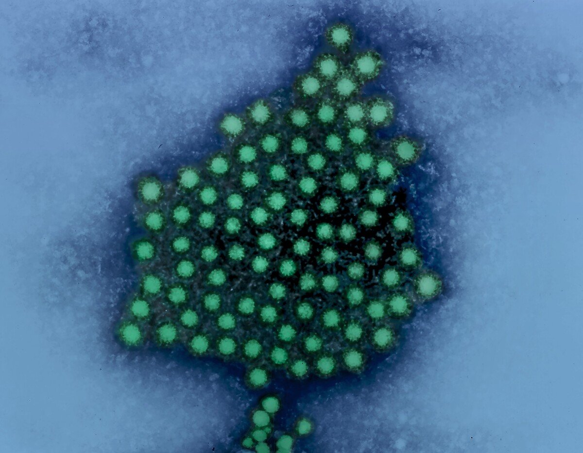 hepatitis a