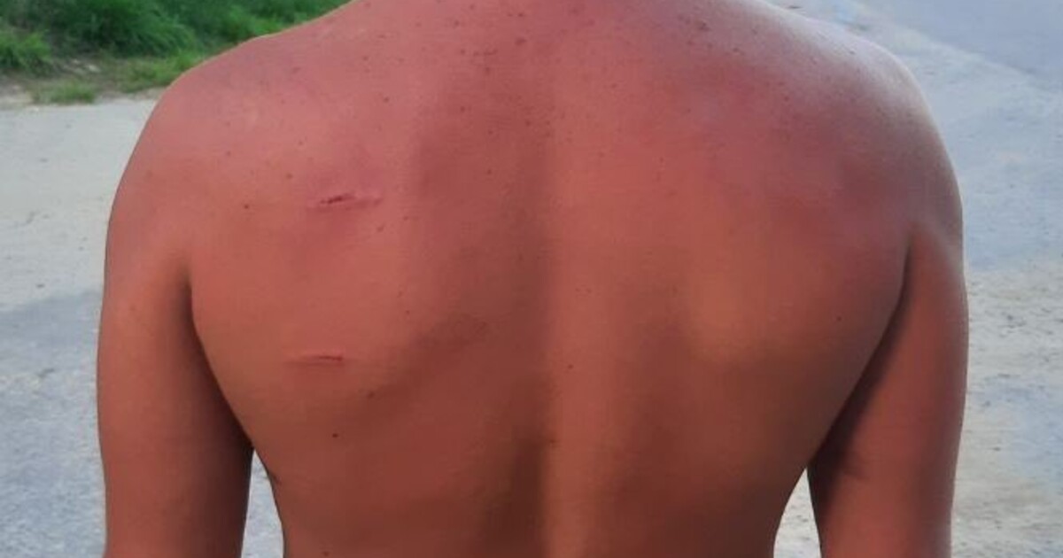 FOTO: Mladík se procházel po makovém poli v červeném tričku. Najel na něj kombajn