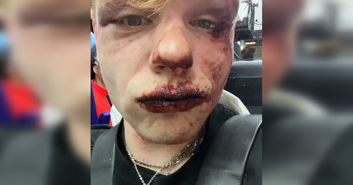 „Bylo to šest lidí na jednoho.“ Rapper IAM Oskar natočil konfrontaci s obsluhou brněnské čajovny, popsal nám podrobnosti