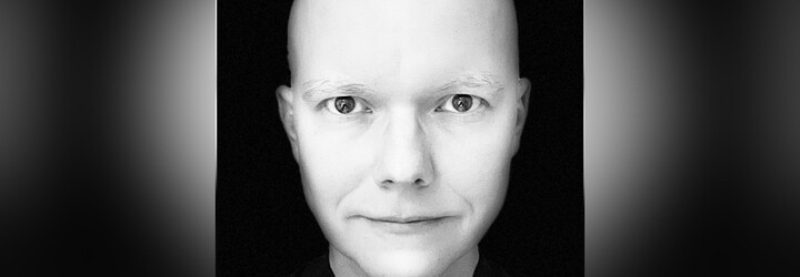 Alopecie v Česku postihuje tisíce lidí. O svůj příběh s autoimunitní nemocí se podělil i bývalý moderátor Tomáš Drahoňovský