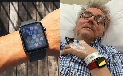 Apple Watch zachránily život důchodci, který spadl v koupelně a upadl do bezvědomí. Utrpěl trojitou frakturu lebky
