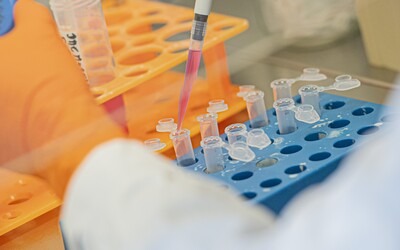 Austrálski vedci tvrdia, že našli „liek na koronavírus.“ Teraz plánujú klinické testy po celej krajine