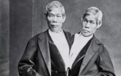 Bizarný príbeh siamských dvojčiat. Oženili sa so sestrami a splodili viac než 20 detí