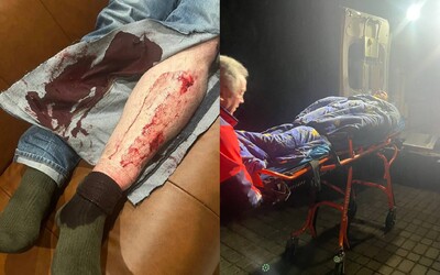 Blízkeho človeka Alexeja Navaľného pred domom napadli kladivom. Ruskému prezidentovi Putinovi posiela priamy odkaz