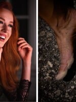 Bývalá moderátorka Fashion TV zdolala 110-kilometrovú ultra trail trasu. Takto vyzerali jej nohy po pretekoch