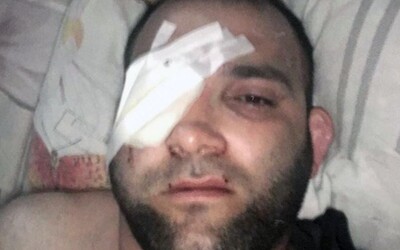 Bývalý MMA bojovník přišel po zásahu ruské policie o oko. Údajně znásilnil 13letou dívku