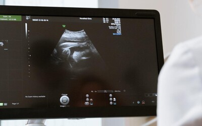 Česko zavede nová pravidla pro darování vajíček. Změní se i finanční odměna