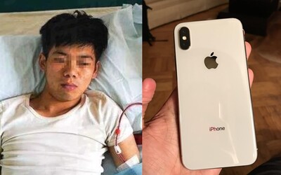 Čínsky tínedžer predal obličku na čiernom trhu, lebo si chcel kúpiť iPhone. Operácia mu zničila zdravie