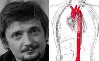 Čo je to akútna disekcia aorty, na ktorú zomrel Daniel Heriban? Začína sa bolesťou hrudníka a chrbta, úmrtnosť je až 73 %