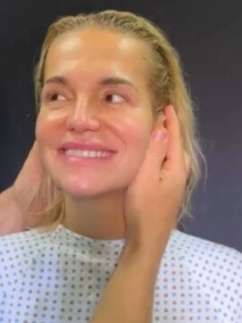 Dara Rolins zúri: Celebritný plastický chirurg bez súhlasu zverejnil jej predoperačné video. Toto malo zostať v tajnosti