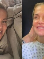 Dara Rolins zuří: Plastický chirurg celebrit zveřejnil její video před operací bez souhlasu