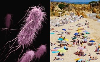 Desiatky populárnych pláží v severnom Taliansku zatvorili. V mori platí zákaz kúpania pre baktériu E-coli