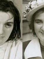 Desivé fotky pacientov pred a po lobotómii. Stali sa z nich neškodné domáce zvieratká, konštatoval lekár 