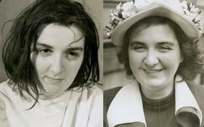 Děsivé fotky pacientů před a po lobotomii. Stala se z nich neškodná zvířátka, konstatoval lékař