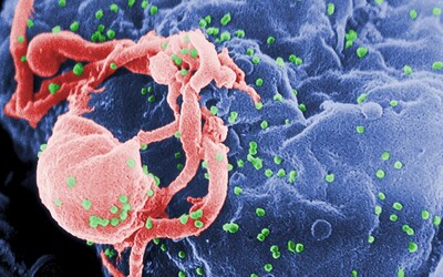 Druhý člověk vyléčený z HIV je i po 2 letech zdravý. Lékaři v Anglii slaví zásadní úspěch