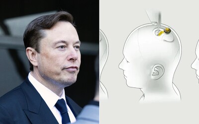 Elon Musk bude môcť implantovať čipy do mozgu. Jeho firma Neuralink dostala povolenie na testovanie na ľuďoch