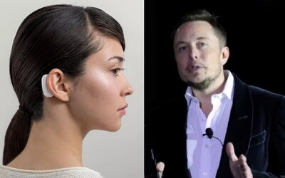 Elon Musk predstavil Neuralink, spôsob ako ovládať počítač a mobil myšlienkami