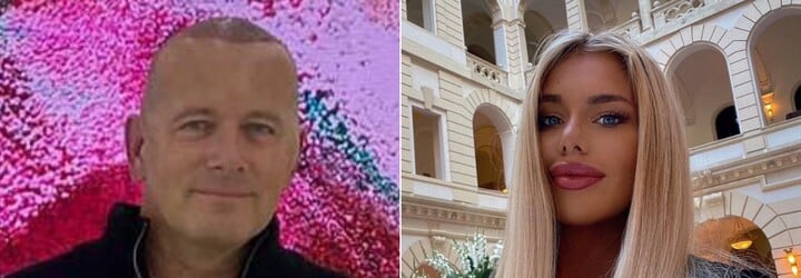 FOTO: Boris Kollár podstúpil transplantáciu vlasov v Turecku. „Nastrelenie“ dostal ako darček od milenky