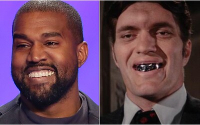 FOTO: Kanye West sa pýši titánovým úsmevom za takmer milión eur