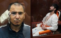 FOTO: Obvinených z teroristického útoku v Moskve mučili. Na genitálie im prikladali drôty a jednému vraj odrezali ucho