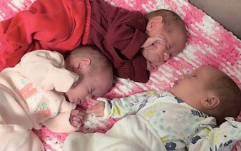 FOTO: V Košiciach sa narodili jednovaječné trojičky. Šanca na takýto „zázrak“ je jedna ku 100 miliónom