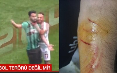 Futbalista v Turecku dorezal protihráčov žiletkou. Prepašoval ju na ihrisko a začal útočiť