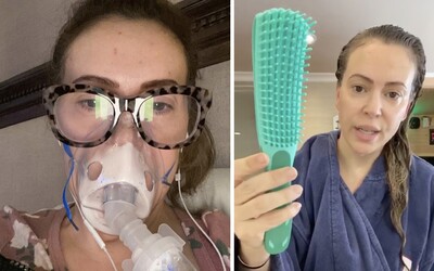 Herečka Alyssa Milano si stále stěžuje na příznaky koronaviru. Ukázala, jak jí vypadávají vlasy i po několika měsících