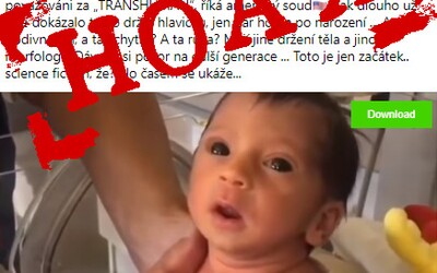 Hoaxeri zneužili fotku novorodenca a tvrdia, že nesie následky proticovidovej vakcíny. Dieťa sa však narodilo rok pred covidom