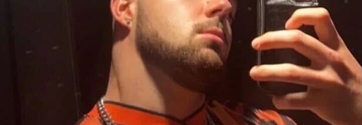 Influencer porušil zákaz sexu po transplantaci vlasů. Ráno se probudil s nateklým obličejem