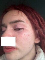 Influencerka Rachellkka prehovorila o domácom násilí: moderátor Tomy Kotty ju bil do krvi a prial jej smrť