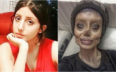 Iránčanka, ktorá mala podstúpiť 50 plastických operácií, aby vyzerala ako Angelina Jolie, má koronavírus