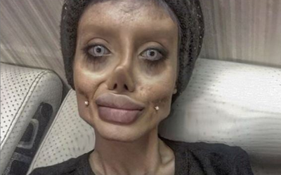 Iránčanka tvrdila, že podstúpila 50 plastických operácií, aby vyzerala ako Angelina Jolie. Teraz ju zatkli za rúhanie