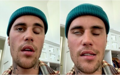 Justin Bieber musel zrušit koncerty, ochrnula mu polovina obličeje. „Tělo mi říká, že musím zpomalit,“ uvedl zpěvák