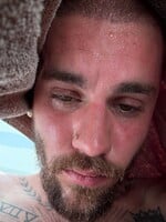 Justin Bieber zverejnil fotky počas detoxu, ako je spotený a vyčerpaný. Fanúšikovia sa oňho boja