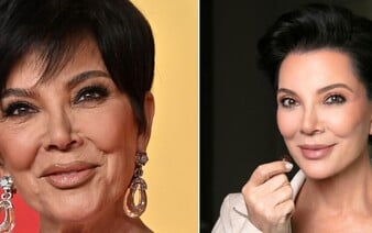 KOMENTÁŘ: Kris Jenner a její virální facelift. Proč umíme omladit o dekády, ale já stále musím protrpět PMS?