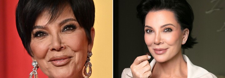 KOMENTÁŘ: Kris Jenner a její virální facelift. Proč umíme omladit o dekády, ale já stále musím protrpět PMS?