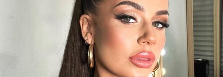 KVÍZ: Jak dobře znáš české celebrity? Vyzkoušej si, jestli je poznáš podle pusy