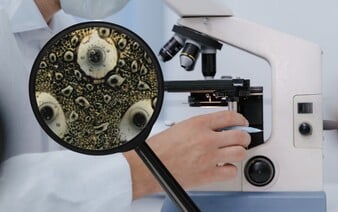 KVÍZ: Uhádneš, aký predmet sa nachádza pod mikroskopom podľa jeho priblíženej fotky?