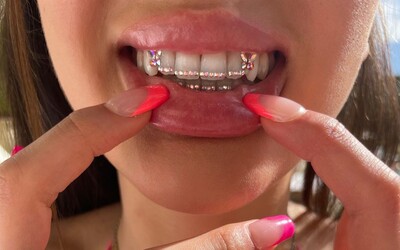 Kamínky na zubech jako trend i riziko pro tvé zuby. Popisujeme, na co si dát při jejich aplikaci pozor
