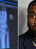 Kanye West měl bolesti ruky, natočil video, jak mu píchají injekci: Příliš mnoho psaní na telefonu, brácho