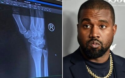 Kanye West mal bolesti ruky, natočil video, ako mu pichajú injekciu: Príliš veľa písania na telefóne, brácho