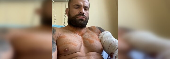 Karlos Vémola je po operácii: lekári potvrdili zlé správy, českého bojovníka budú operovať znovu