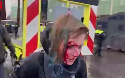 Krvavé zranění Češky při protestech v Nizozemsku: Vodní dělo ji odhodilo na beton, o který si rozbila hlavu