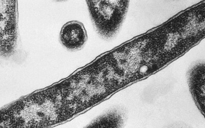 Legionella v Polsku zabila již 11 osob. Zákeřná bakterie se rozšířila do dalších regionů