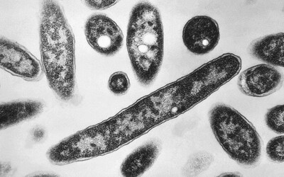 Legionella v Polsku zabila již 11 osob. Zákeřná bakterie se rozšířila do dalších regionů