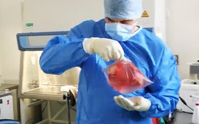 Lékaři z IKEMu provedli výjimečnou transplantaci. Mladý muž může žít normální život i bez slinivky