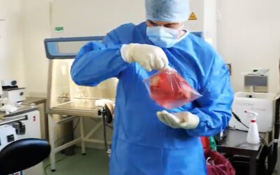 Lékaři z IKEMu provedli výjimečnou transplantaci. Mladý muž může žít normální život i bez slinivky