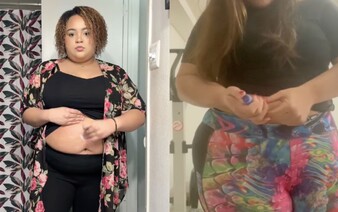 Lieky na obezitu sú bezpečné, no nesmieš ich zneužívať (RADÍ ODBORNÍK)