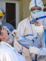 Ľudí na Slovensku možno čaká plošné testovanie na koronavírus. Štátne orgány už rokujú o nákupe testov