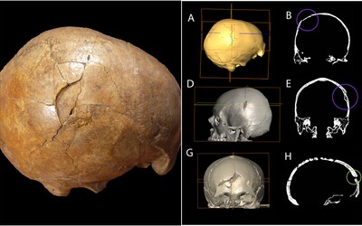 Lidé se vraždili už před 33 000 lety. Lebka, kterou našli v Rumunsku, má zranění po útoku kamenem či palicí